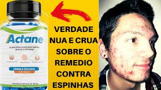 VERDADE NUA E CRUA SOBRE O REMEDIO CONTRA ESPINHAS -ACTANE