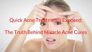 Quick Acne Treatments Exposed - The Truth Behind Miracle Acne Cures