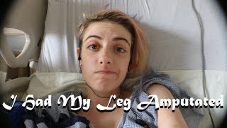 I Had My Leg Amputated