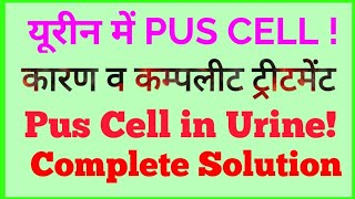 #Pus Cell in urine#UTI PUS CELL#यूरिन में पस सेल का इलाज#PUS CELL treatment#UTI इंफेक्शन।