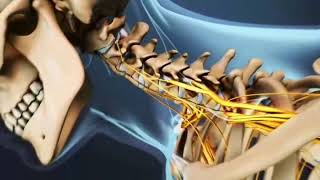 Radiculopatia Cervical