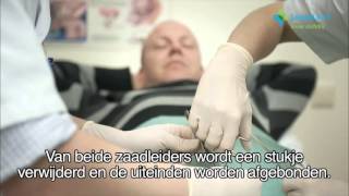 Vasectomie
