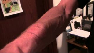 Taipan bite. 3/4. Part 2 . Tim Friede