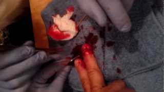 man amputates his own finger