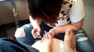 Hairy toes