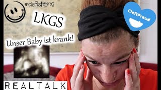 LKGS | Das BABY ist KRANK ! | Entwicklungsstörung | #Cleftproud