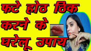 How to cure dry lips | Fate hoth kaise thik kare