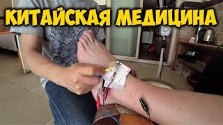 ИГЛОУКАЛЫВАНИЕ ? В КИТАЕ. НЕТРАДИЦИОННАЯ КИТАЙСКАЯ МЕДИЦИНА. ВИКТОР ПОДВЕРНУЛ НОГУ.