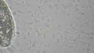 Спириллы (Spirillum volutans)