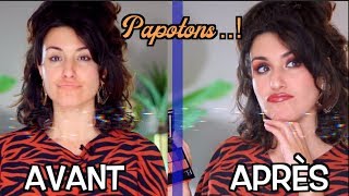 CHIT CHAT | Activité en couple, mon chat blessé etc...