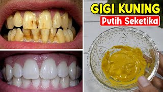 PAKAI INI SAJA, GIGI KUNINGMU JADI PUTIH KEMBALI DALAM SEKEJAP [BERDASARKAN PENGALAMAN] | SEHAT TUBE