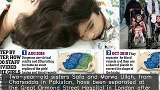 Conjoined twin girls separated after 55 hours of operations