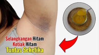 CUMA RUTIN MENGOLESKAN INI, LIHAT PERUBAHANNYA PADA KULIT ANDA