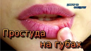 ПРОСТУДА НА ГУБАХ / CHILL ON THE LIPS