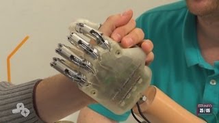 Médecine: Main bionique commandée par la pensée