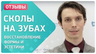 Реставрация передних зубов ? отзыв пациента клиники Smile-at-Once