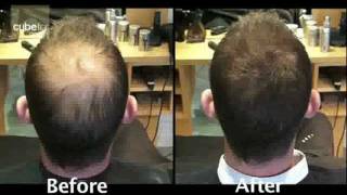 Mens Hair Loss product solution from Toppik
