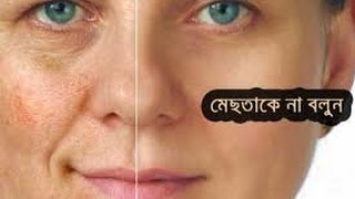 মেছতার দাগ চিরতরে দূর করুন সহজ ২টি উপায়ে