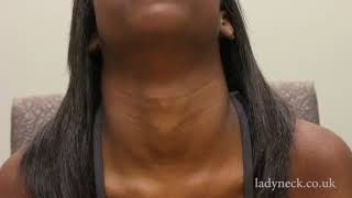 IB Long Neck with a Female Adam's Apple
