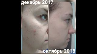 Двухфазный пилинг NovAge Oriflame код 33434
