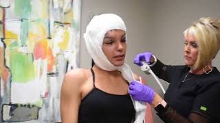 Facial Feminization Surgery