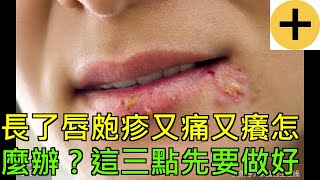 長了唇皰疹，又痛又癢怎麼辦？這三點先要做好
