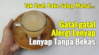 HANYA RUTIN PAKAI INI, GATAL-GATAL AKUT MAUPUN KRONIS LANGSUNG SEMBUH