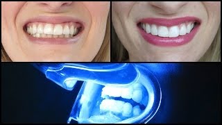 VLOG: Natural Teeth Whitening?!