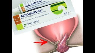 ★Чудо-Мазь ЛЕВОМЕКОЛЬ, не только сражается с инфекцией и воспалением, но и лечит ГЕМОРРОЙ.