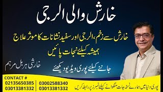 KHARISH Allergy Ka ilaaj | Hakeem Shah Nazir
