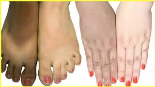Skin whitening remedy || 100% effective remedy || DIY || Indian youtuber priyamit