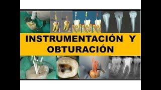 "INSTRUMENTACION Y OBTURACIÓN" por el Dr. Nestor Jaime