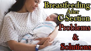 Breastfeeding After a C-Section. Problems and Solutions