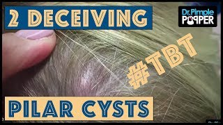 Reminiscing with Dr. Pimple Popper - TBT