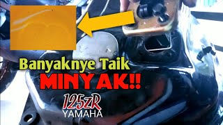 Service Tangki Minyak 125ZR • Awas Sebelum Tersumbat!
