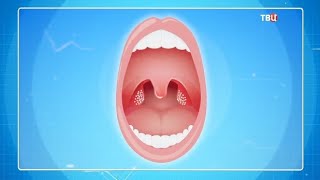 Мифы о тонзиллите. Доктор И...