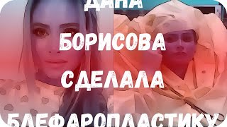 Дана Борисова сделала блефаропластику