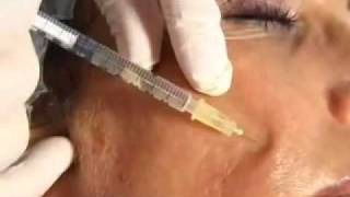 Nucleonix injection video
