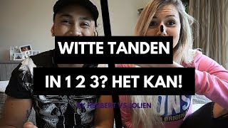WITTE TANDEN in 1 2 3?! Watch now