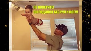 НЕ ПОВЕРИТЕ!! ОН РОДИЛСЯ БЕЗ РУК И НОГ!! Необычный мальчик-NEWS–Шокирующие новости–Новости онлайн