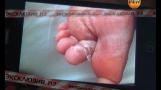 Турция. Заболел - пошел вон! Экстренный вызов 112