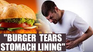 Burger eating competition held in Delhi, winner vomits blood | Oneindia News