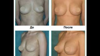 Большая грудь Оксана Атаева