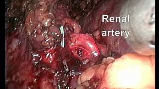 Adrenal_styopushkin