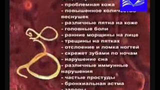 +++ Есть ли у Вас ПАРАЗИТЫ статистика и симптомы +++