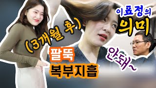 복부와 팔뚝지방흡입한 규은이의 5주차, 3개월차 경과