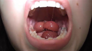 Fruit vore