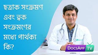 ছত্রাক সংক্রমণ এবং ত্বক সংক্রমণের  মধ্যে পার্থক্য কি?  #AsktheDoctor