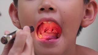 Pediatrics Respiratory Physical Exam Video (Laos)