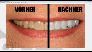 Gimp Tutorial Deutsch: gelbe Zähne bleichen/weiß machen